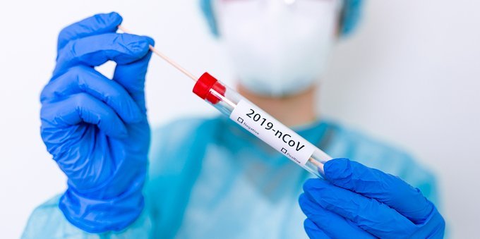 Test Covid-19 fatturati illecitamente: il Consiglio federale dà il via alle indagini