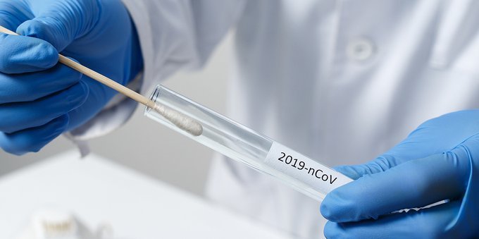 Covid, in arrivo il nuovo test di Roche contro la sottovariante Centaurus