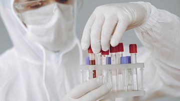 Ricerca: osteoporosi, risultati incoraggianti dalla farmaceutica Sandoz