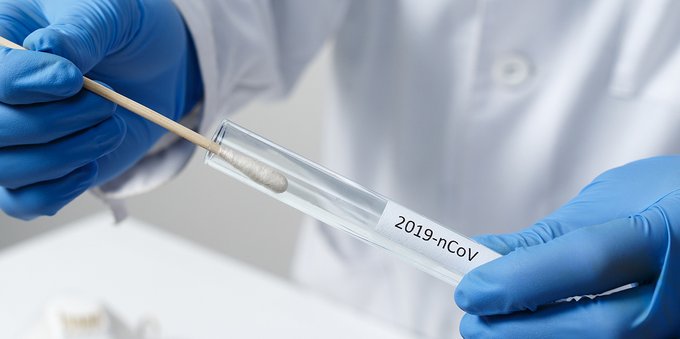 Test molecolari PCR: la Confederazione rimborsa alcuni casi. Ecco quali
