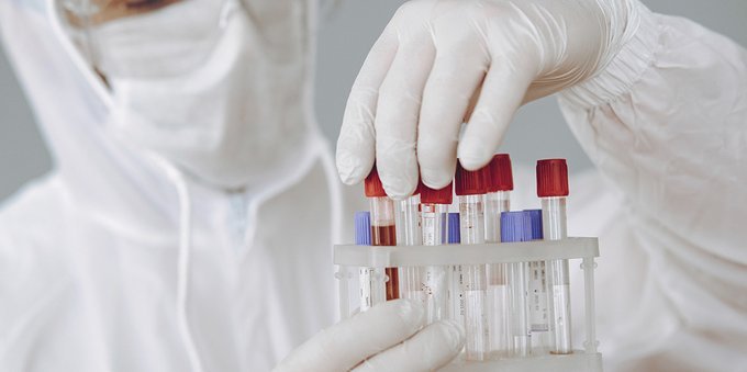 ITALIA Catania, 36enne risulta positivo a Covid, vaiolo delle scimmie e Hiv