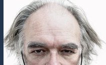 Capelli, dopo il Covid li perde una persona su tre. Ecco perché