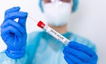 Contagi COVID-19 in aumento in Svizzera, si teme nuova ondata