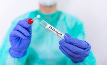 Ecco la variante Gryphon. Dalla Cina la minaccia di una nuova ondata Covid 