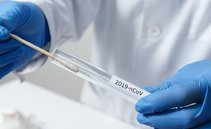 Salute: quanto è costata la pandemia da Coronavirus alle casse svizzere? I dati